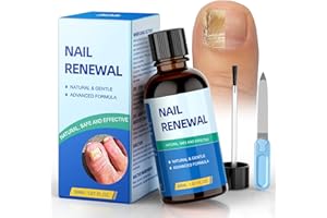 DRALOT 5X Powerful Toenail Fungus Treatment Extra Strength with Acetic Acid, Effective Fungus Nail Treatment for Toenail & Fingernail, Nail Repairs for Damaged, Discolored Nails & Athletes Foot（1.01oz）