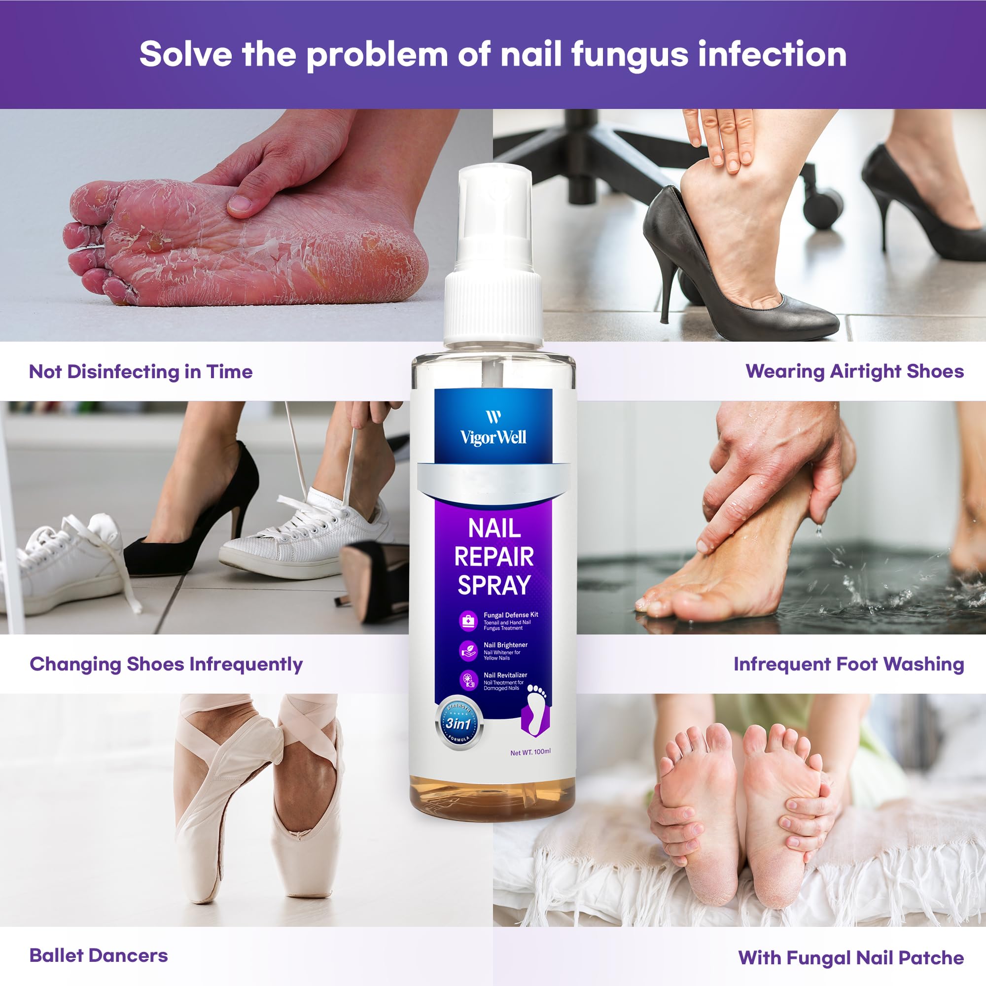 Nail Fungus Treatment For Toenail Spray - 3-In-1 Toe Nail Fungus Treatment Extra Strengt - Toenail Fungus Treatment Renews and Strengthens Nails (100ml) - Image 2