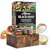 WeiWeiLa Organic African Black Soap, African Soap for Acne & Dark Spots, Raw Black Soap Bar for All Skin Types - Face, Body, Hair, 3.53 oz