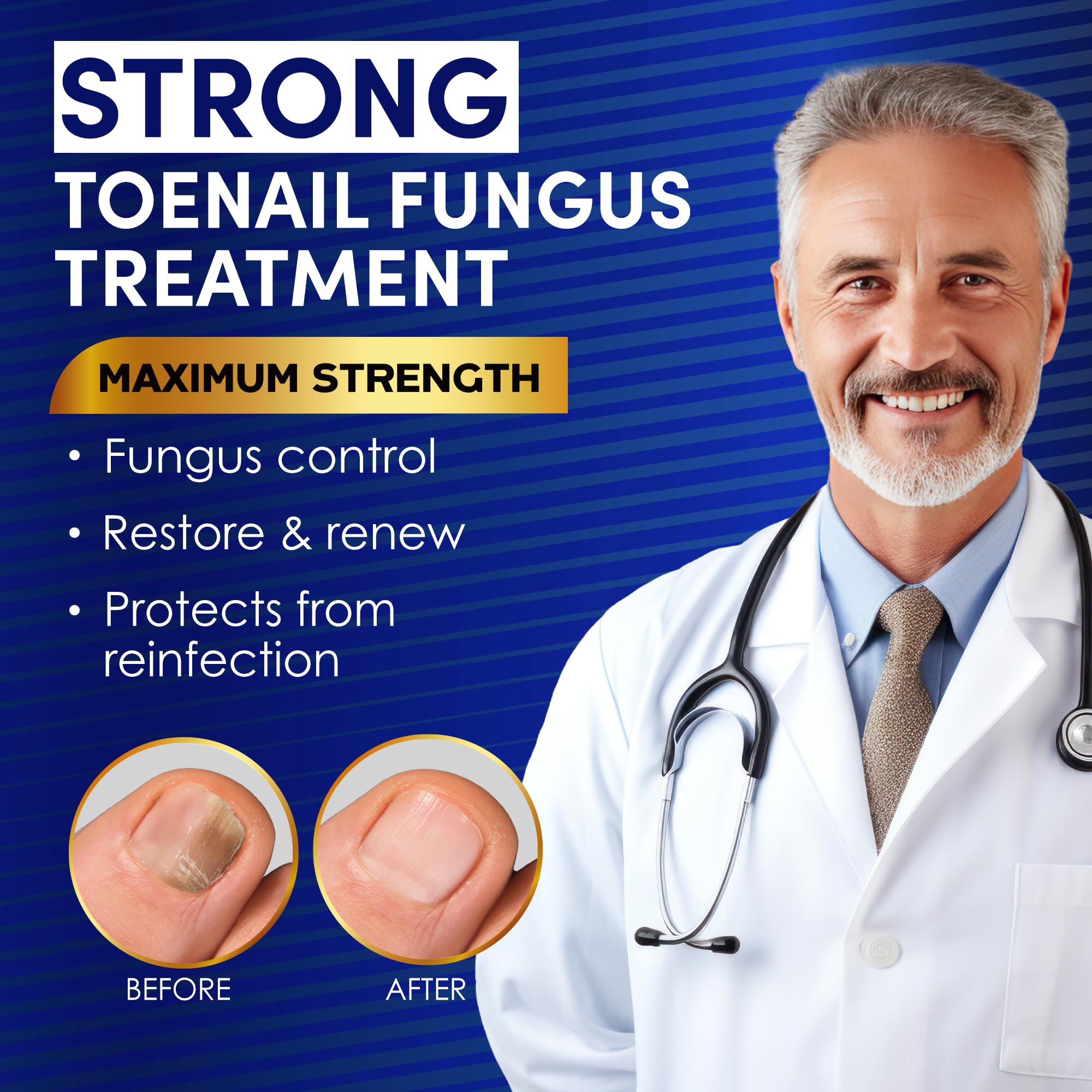 2 Bottle Toenail Fungus Treatment Extra Strength, 25% Undecylenic Acid, Tea Tree Oil, Toe Nail Fungus Treatments, Toe Fungus Treatment for Toenail - Image 2