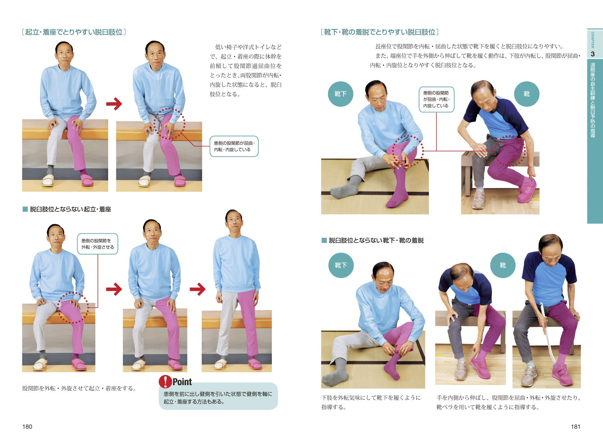 大腿骨近位部骨折のリハビリテーション Visual Lecture On Rehabilitation 林 泰史 末永 健一 林 泰史 末永 健一 本 通販 Amazon