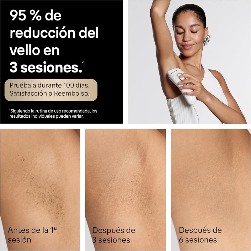 Silk·expert Pro 5 epiladores de luz pulsada, IPL, depilação a laser caseira para rosto e corpo, redução permanente de cabelo, depilação a laser com acessórios, inclui Precision Head, PL5321