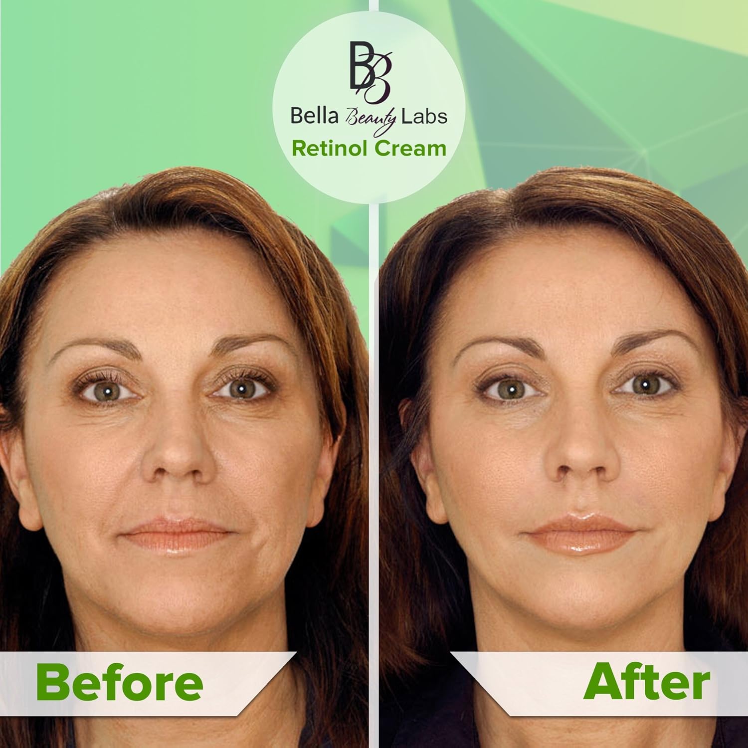 Retinol Moisturizer Anti Aging Cream for Face and Eye Area - With Hyaluronic Acid - 2.5% Active Retinol - Vitamin E - Reduce Appearance of Wrinkles and Fine lines - Best Day and Night Face Cream: Beauty