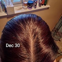 Amazon Com Customer Reviews Phyto Re30 Anti Grey Hair Treatment