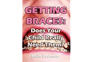 Getting Braces: Does Your Child Really Need Them?