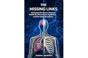 The Missing Links: Navigating the Science Between COVID-19, Ehlers-Danlos Syndrome, and One-Sided Breakdown