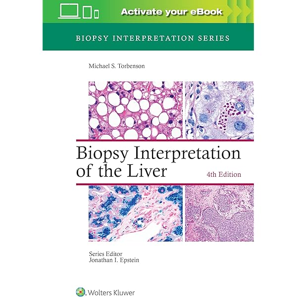 Muscle Biopsy: A Practical Approach: 9780702074714: Medicine