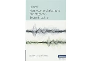 Clinical Magnetoencephalography and Magnetic Source Imaging