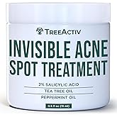 TreeActiv Invisible Salicylic Acid Spot Cream, Original Formula Lightweight Face & Body Cream for Acne-Prone Skin, Daily Use for Teens & Adults, Clear-Drying, Gentle Formula, 0.5 fl oz