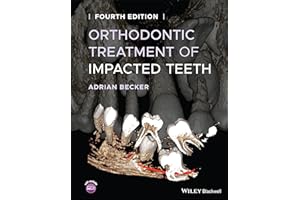 Orthodontic Treatment of Impacted Teeth