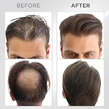 THICK FIBER Hair Fibres 25g Dark Brown Thickening Hair Powder view 7