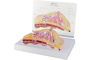 GPI Anatomicals - Breast Cross-Section Model, Replica Showing Common Pathologies for Human Anatomy, Physiology Education, Anatomy Model for Doctor's Offices and Classrooms, Medical Learning Resources