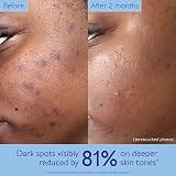 Caudalie Vinoperfect Brightening Serum with Viniferine - 98% Natural view 4