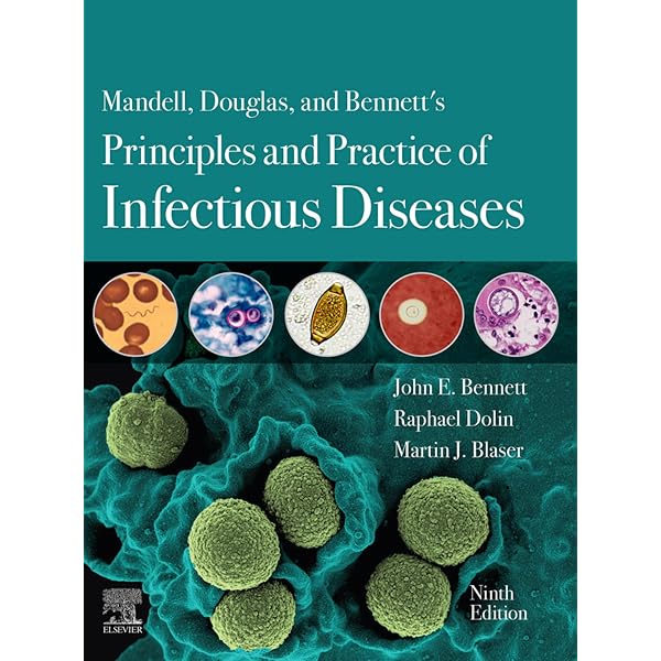 Amazon.com: Comprehensive Review of Infectious Diseases eBook