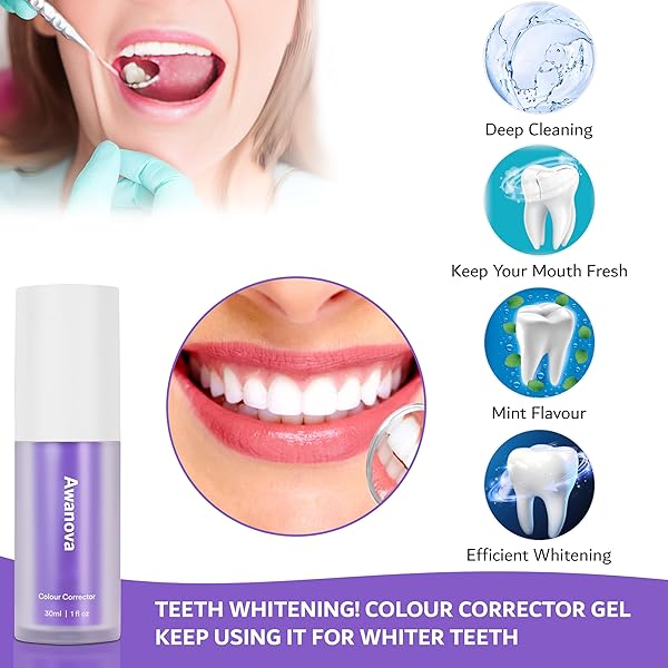 AWANOVA 30ML PURPLE TOOTHPASTE FOR TEETH WHITENING, COLOR CORRECTOR TOOTHPASTE, ADVANCED STAIN REMOVAL, HEALTHY SMILE, CONFIDENT YOU WITH PURPLE TEETH WHITENING GEL, COLOUR CORRECTOR