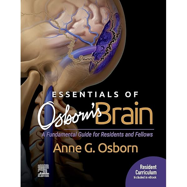 Osborn&#39;s Brain:他合わせて5冊 Amazon.com: Osborn's Brain: Osborn's Brain E-Book eBook