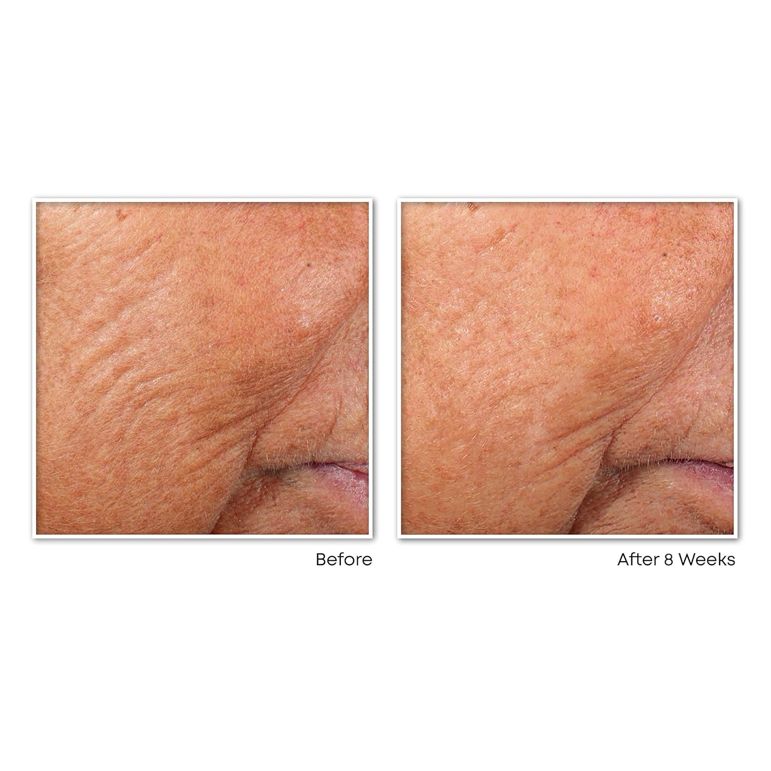 RoC Retinol Correxion Line Smoothing Night Retinol Serum, 30 Capsules: Beauty