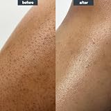Transforming Body Lotion Fragrance Free 200ml for KP Dry Skin view 4