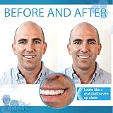 Instant Smile Complete Your Smile Temporary Tooth Replacement Kit 40 Teeth view 3