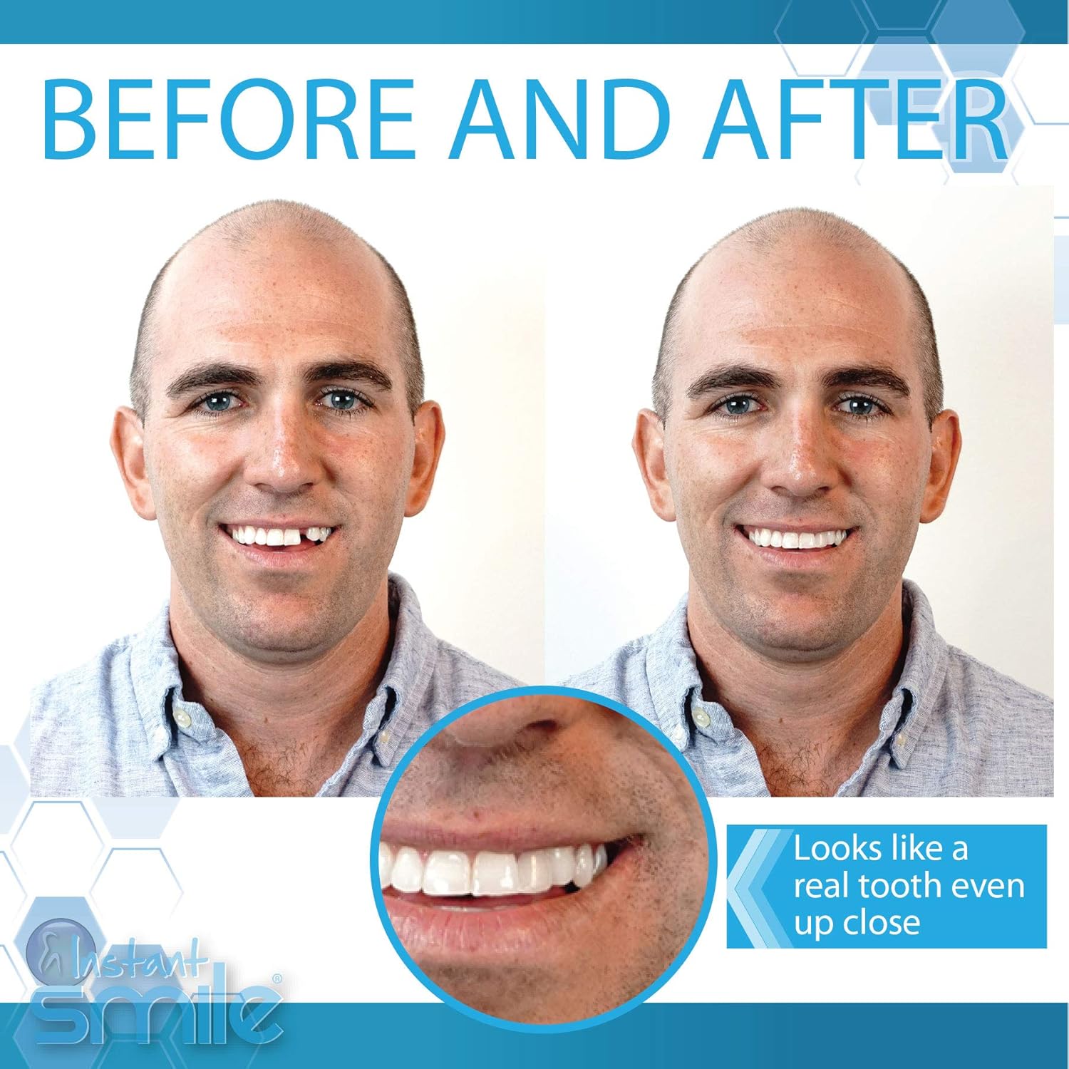 Instant Smile Complete Your Smile Temporary Tooth Replacement Kit - Replace a missing tooth in minutes - Patented : Beauty