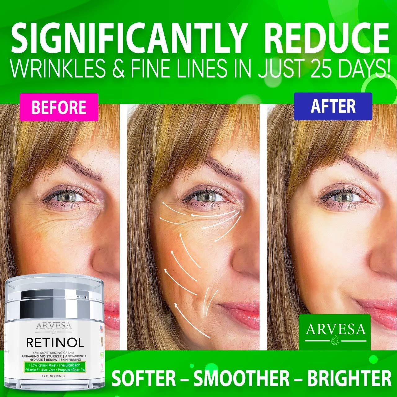 Anti Aging Retinol Moisturizer Cream for Face, Neck & Décolleté - Made in USA - Wrinkle Cream for Women and Men with Hyaluronic Acid and Active Retinol 2.5% - Best Day and Night - Results in 4 Weeks: Beauty