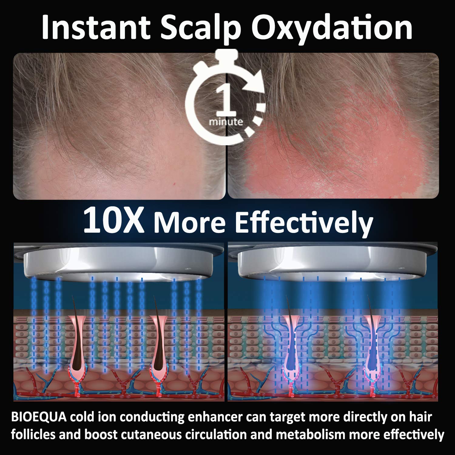 Hair Regrowth Hair loss Treatment - BIOEQUA Enercharger (H1) Cold Ion Charging Scalp Revitalization Technology for Boosting Follicles Vitality and Regaining Hair Density for Men and Women : Beauty
