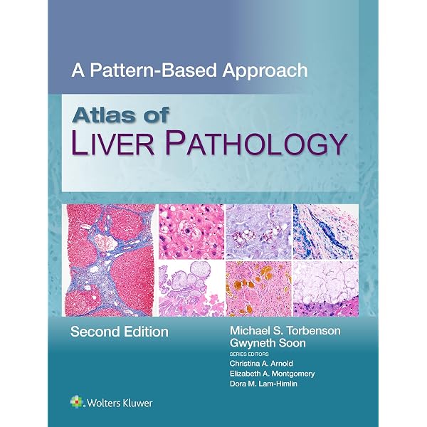 MacSween's Pathology of the Liver, E-Book (English Edition
