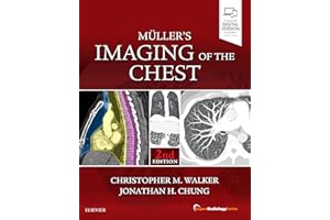 Muller's Imaging of the Chest: Expert Radiology Series