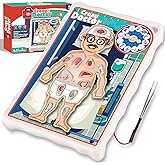 Operate Board Game for Kids Ages 3-8&ndash;Fine Motor Skill Toy with Vibration | Educational Hands-On Activity for Boys and Girls&ndash;Interactive Family Game for 1 or More Players&ndash;Gift for Christmas, Birthdays