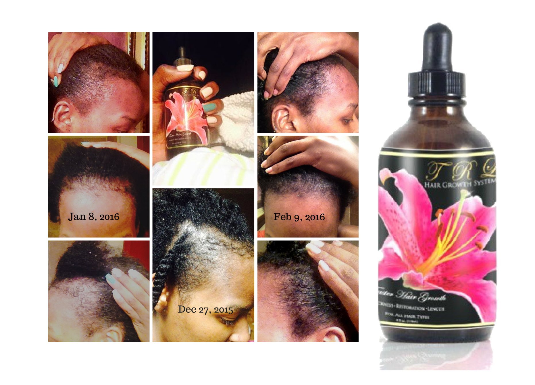 TRL Faster Hair Growth (2 Pk.) Black Castor Oil, Coconut Oil Hair