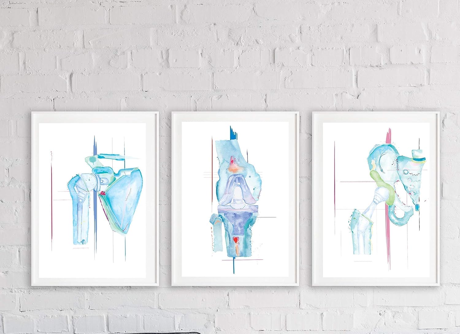 International journal of orthopaedics picture