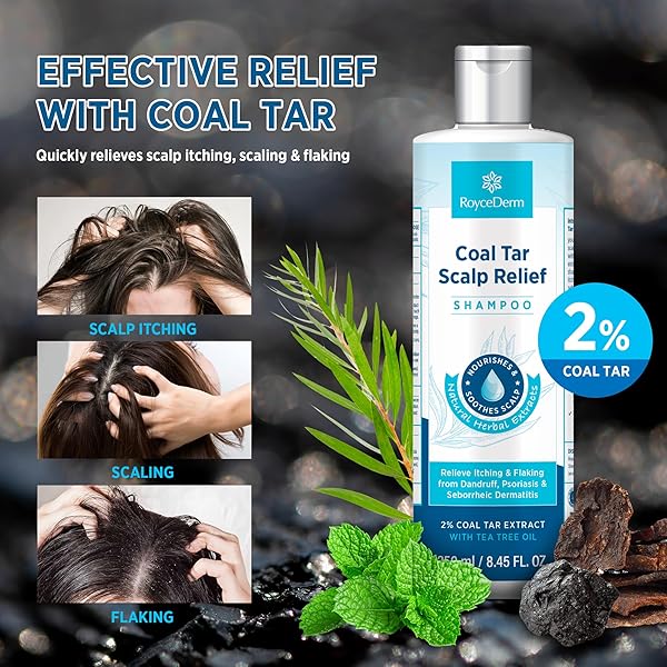 ROYCEDERM COAL TAR DANDRUFF SHAMPOO: EXTRA STRENGTH 2% COAL TAR EXTRACT MEDICATED GEL FOR RAPID SCALP HAIR RELIEF TARGETS DANDRUFF, PSORIASIS, AND SEBORRHEIC DERMATITIS – HYDRATING & NATURAL FRAGRANCE