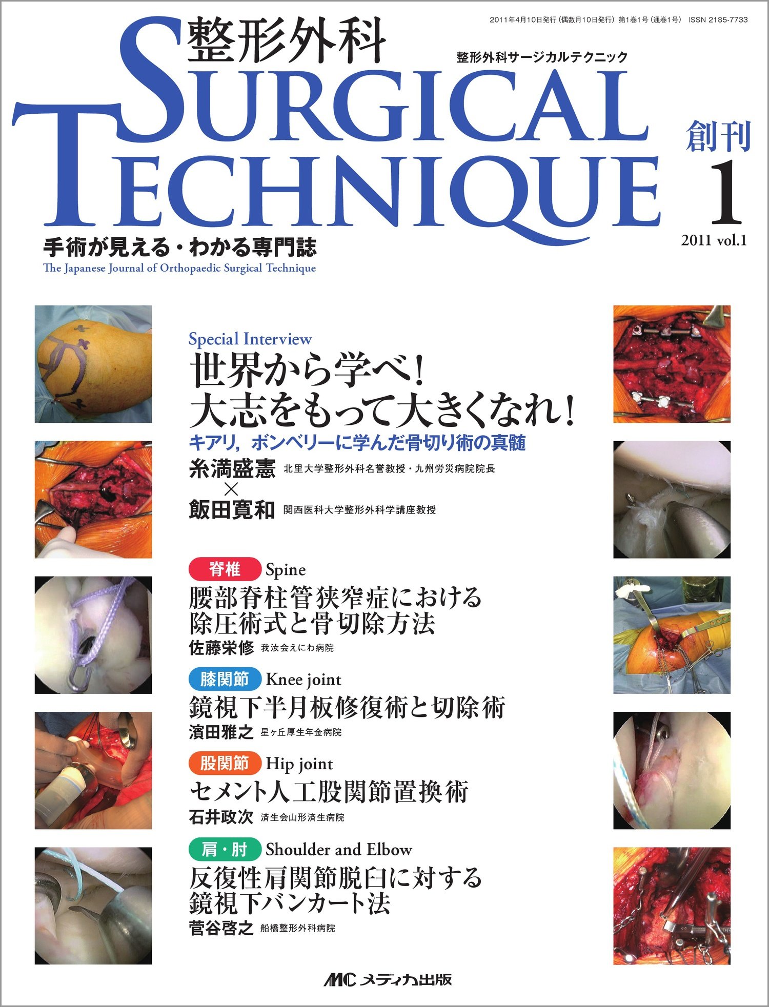 整形外科サージカルテクニック 1 本 通販 Amazon 整形外科サージカルテクニック 1 本 通販 Amazon