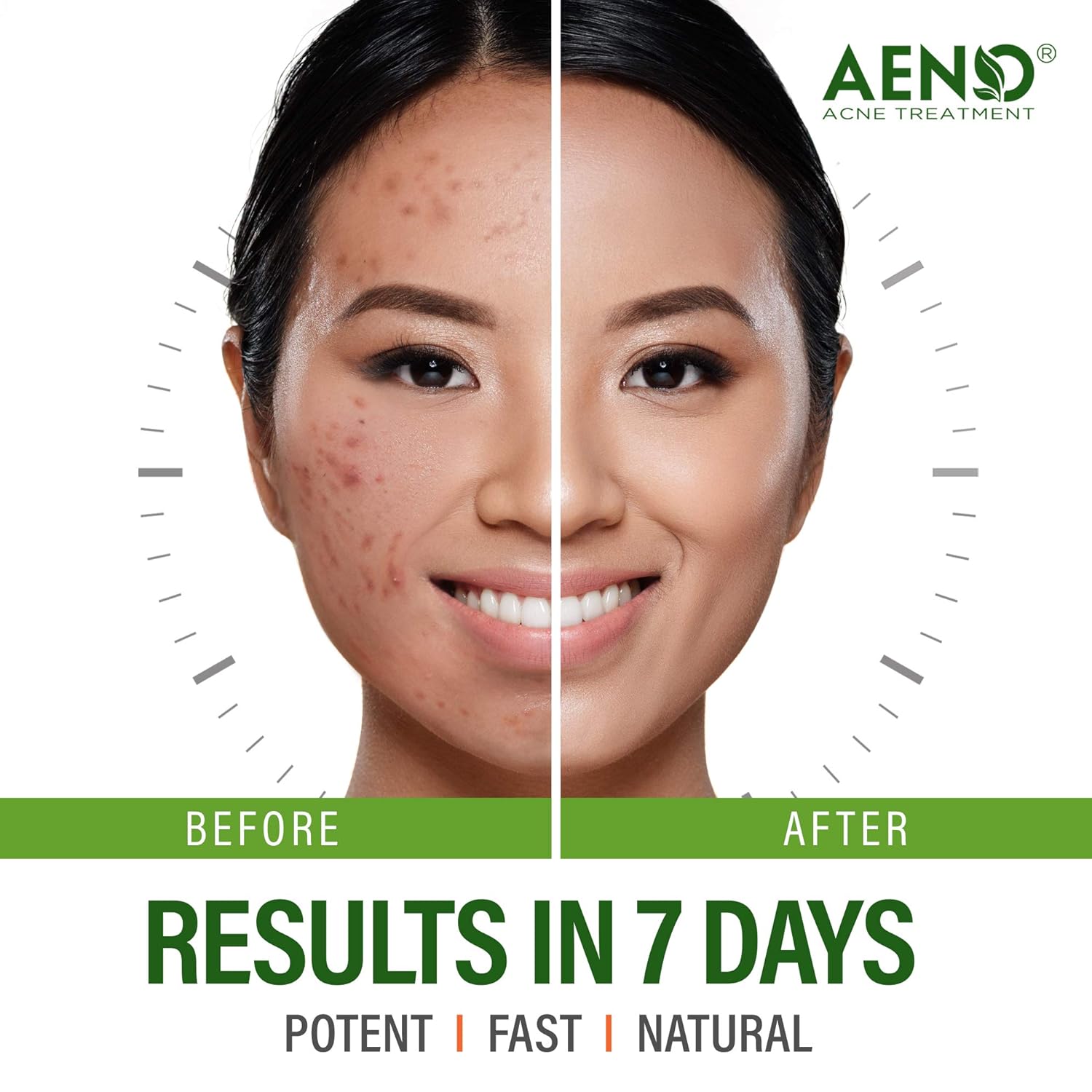 best meds for cystic acne