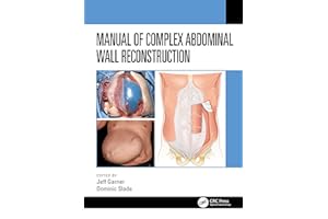 Manual of Complex Abdominal Wall Reconstruction