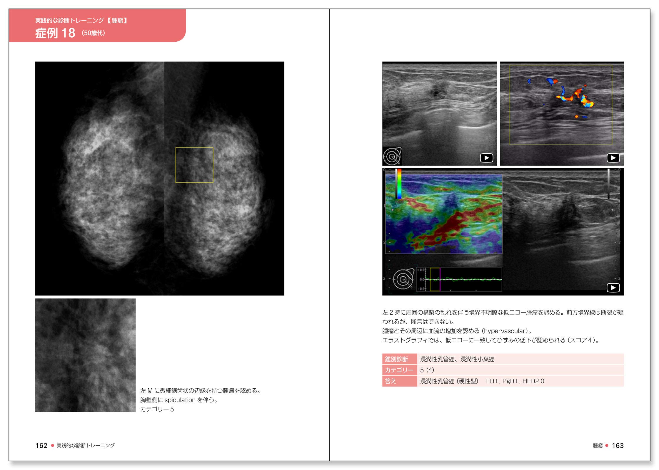 乳房超音波入門 動画で学ぶ厳選100症例 9784784948857 Amazon Com Books