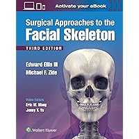 Local Flaps in Facial Reconstruction: 9780323683906