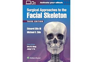 Surgical Approaches to the Facial Skeleton