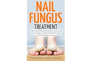 Nail Fungus Treatment: Cure Nail Fungus Naturally With This Fast Toenail Fungus Treatment and Toenail Fungus Cures (nail fung