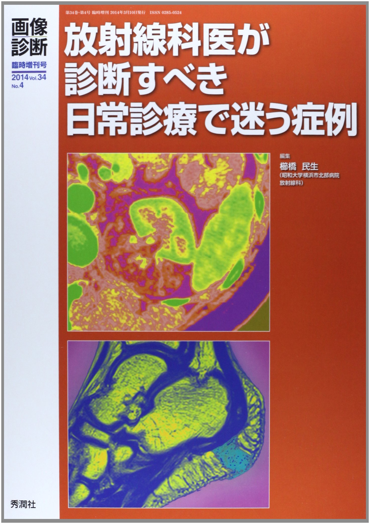 画像診断2014年3月臨時増刊号vol 34 No 4 放射線科医が診断すべき日常診療で迷う症例 櫛橋民生 本 通販 Amazon