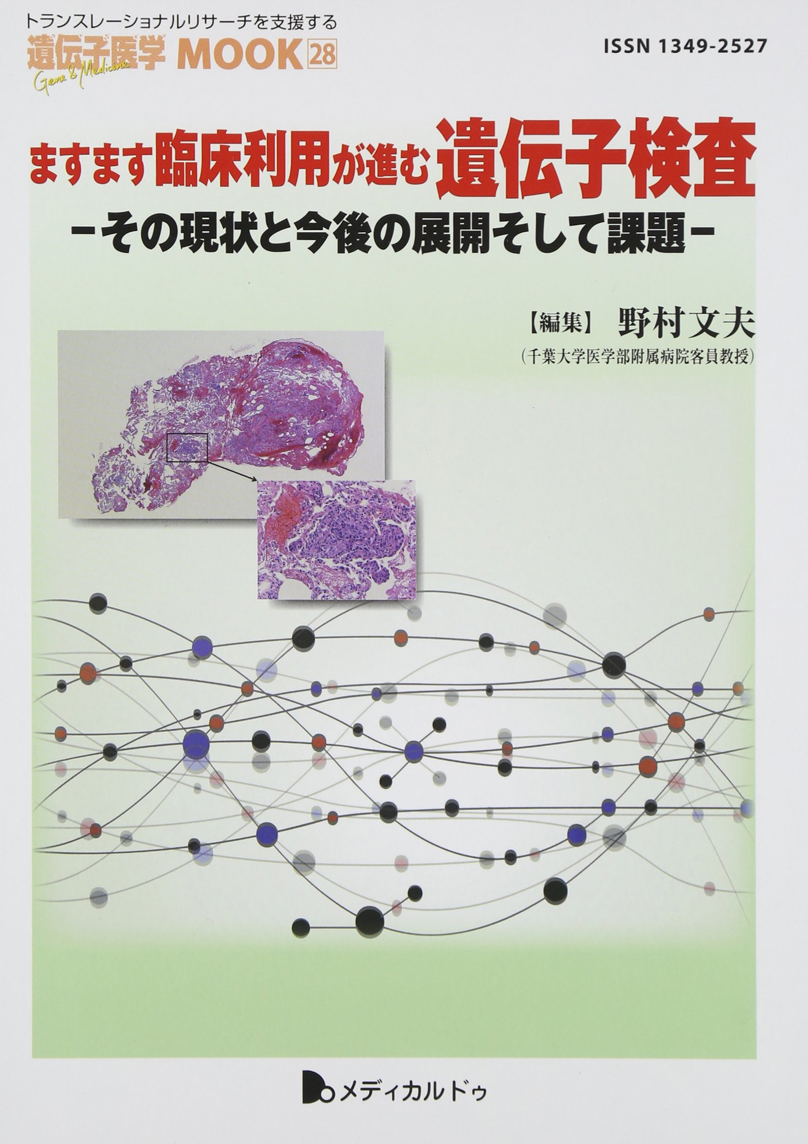 アマゾン