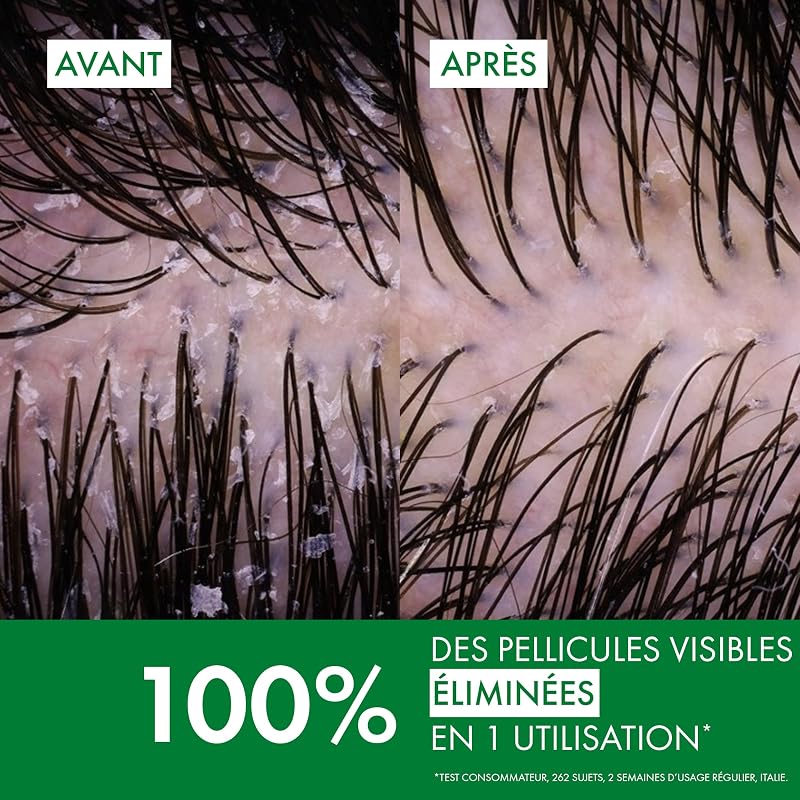 Dercos Shampooing Anti-Pelliculaire DS Cheveux Normaux à Gras