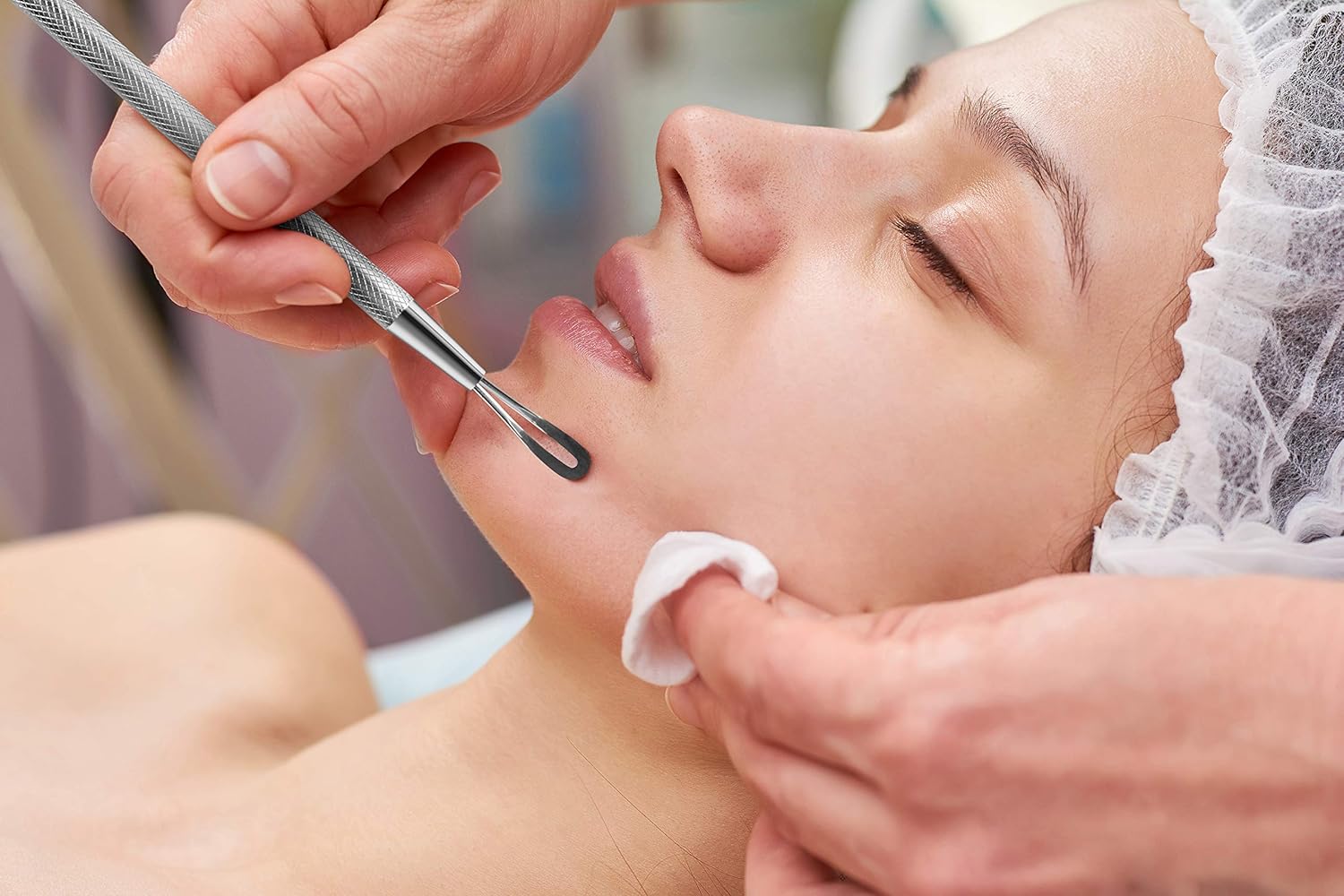 Professional Blackhead and Blemish Remover - Pimple Comedone Removal 2-In-1 Extractor Tool (Round): Beauty