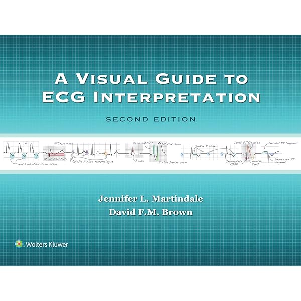 Amazon.com: Chou's Electrocardiography in Clinical Practice