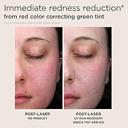 EltaMD UV Skin Recovery Green Tint All