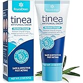 Roycederm Tinea Versicolor Treatment, Athletes Foot Treatment, Ringworm Treatment for Humans, for Tinea Versicolor & Pedis,Fast Healing Anti Fungal Skin Cream - Multi-Functional