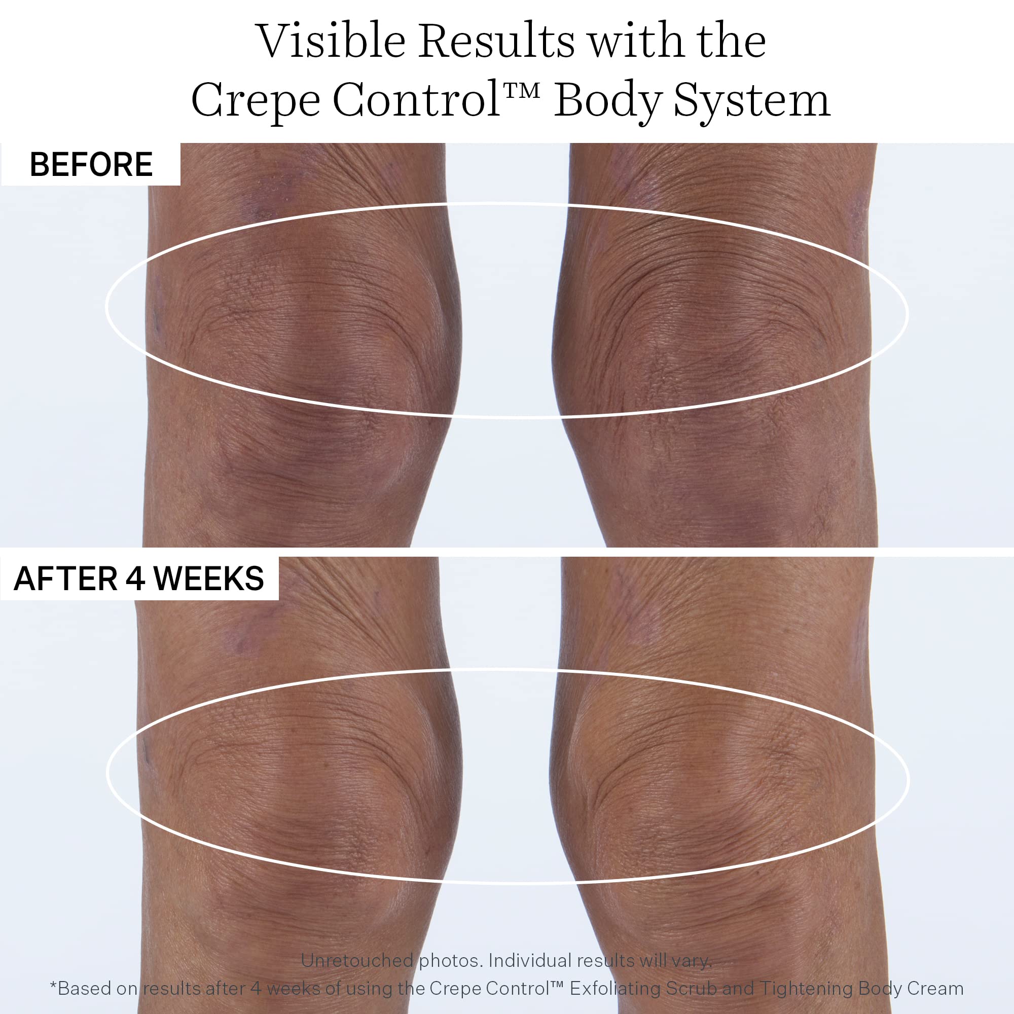 StriVectin Tighten & Lift Crepe Control Body Creams & Treatments, Improving Crepey & Saggy Skin, Hydrating Moisture for your Skin