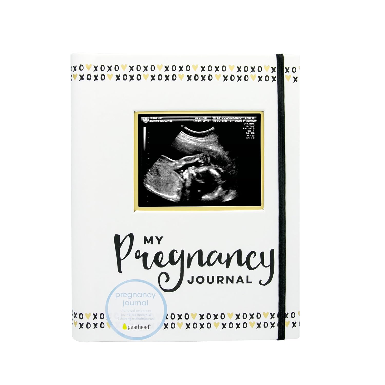 Pearhead My Pregnancy Journal, Pregnancy Book, Capture Every Precious Moment of Your Pregnancy, Gift for New Mom : Baby