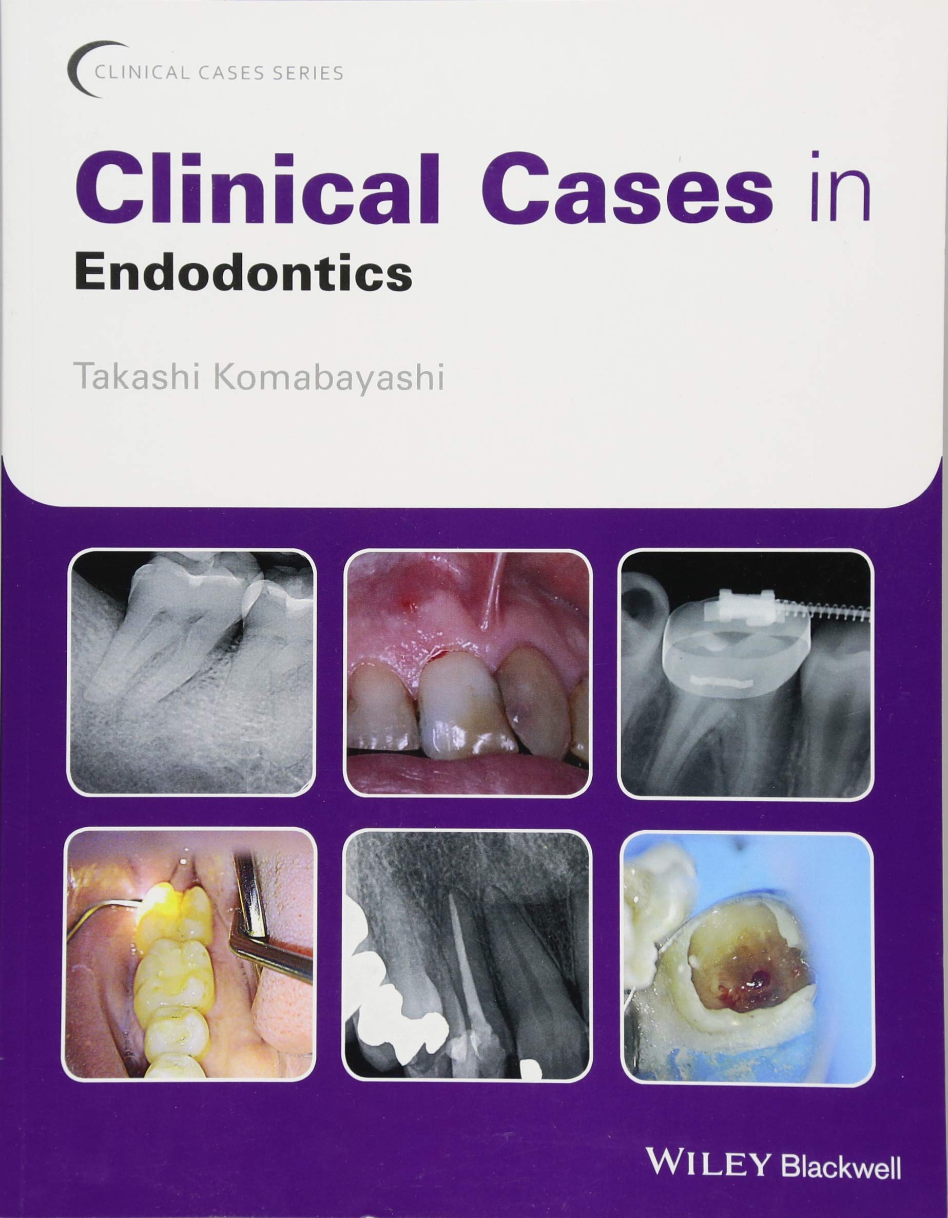 (Free Download) Clinical Cases in Endodontics (Clinical Cases (Dentistry)) Online SRIUTAMIEEE01