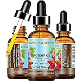 Botanical Beauty ROSEHIP SEED OIL 100% Pure Natural Refined Cold-Pressed Carrier Oil 1 Fl Oz 30 ml For Face, Skin, Body, Hair, Lip, Nails, Rich in vitamin C, Vitamin E, Anti-Aging